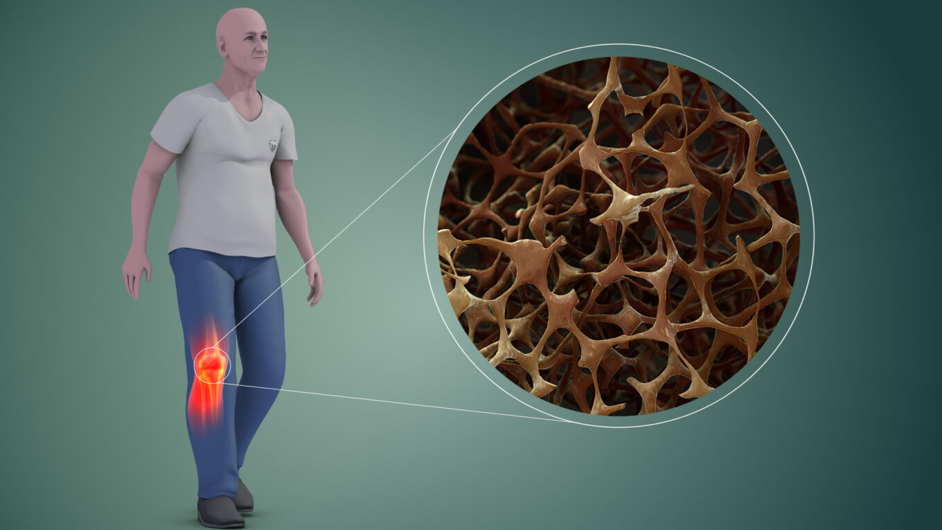 Calcium Supplement is the largest segment driving the growth of Postmenopausal Osteoporosis Market