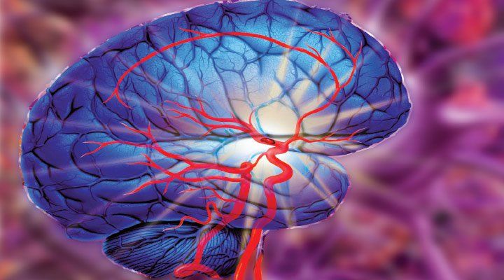 The Global Acute Ischemic Stroke (AIS) Market Is Estimated To Propelled By Increasing Adoption Of Advanced Stroke Treatment Procedures