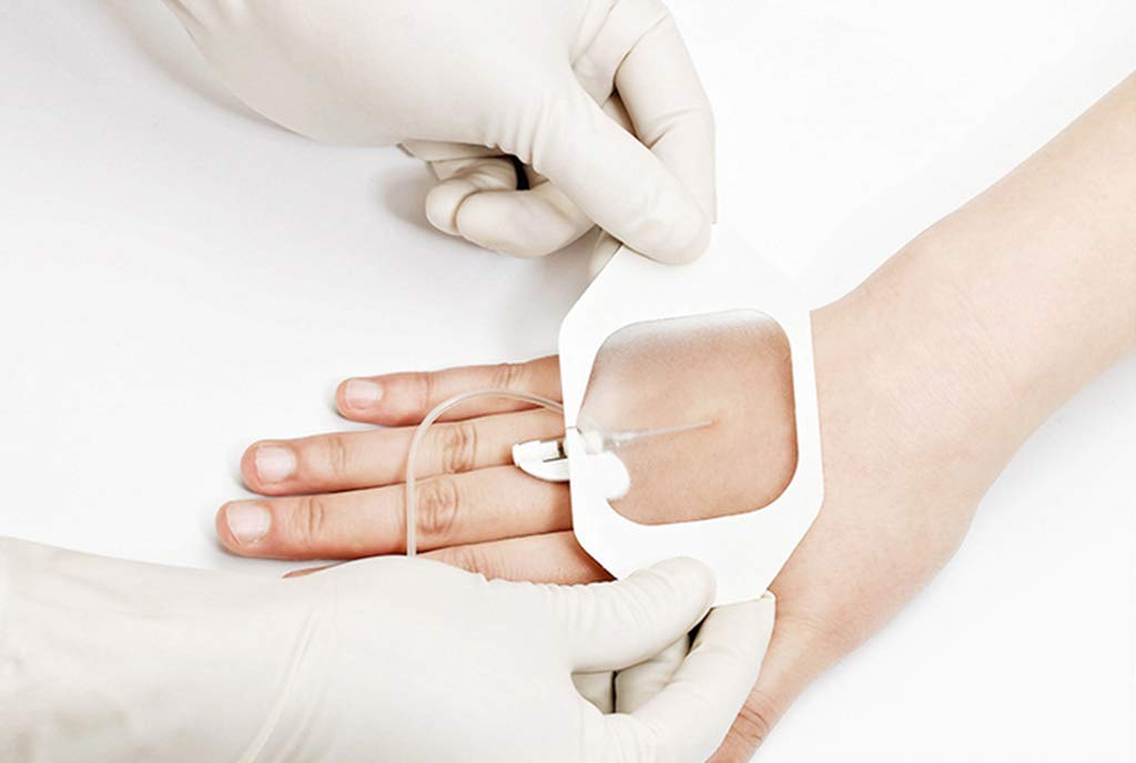 The wound healing films market has wide applications in chronic