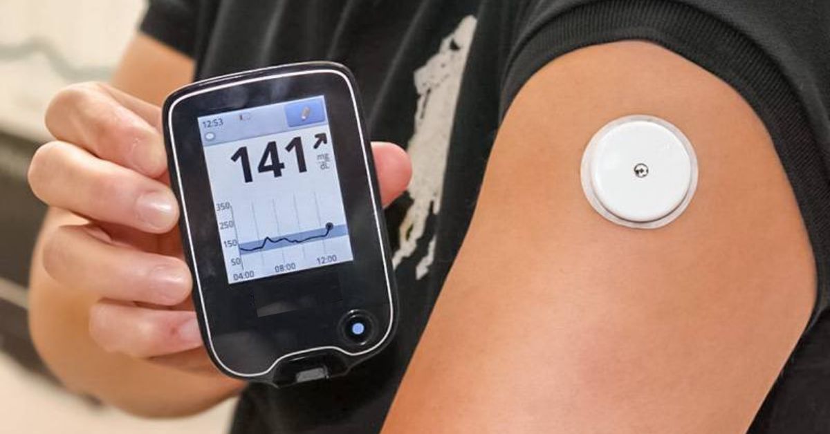 Blood Glucose Monitoring Market is expected to be Flourished by Adoption of Advanced Glucose Monitoring Systems
