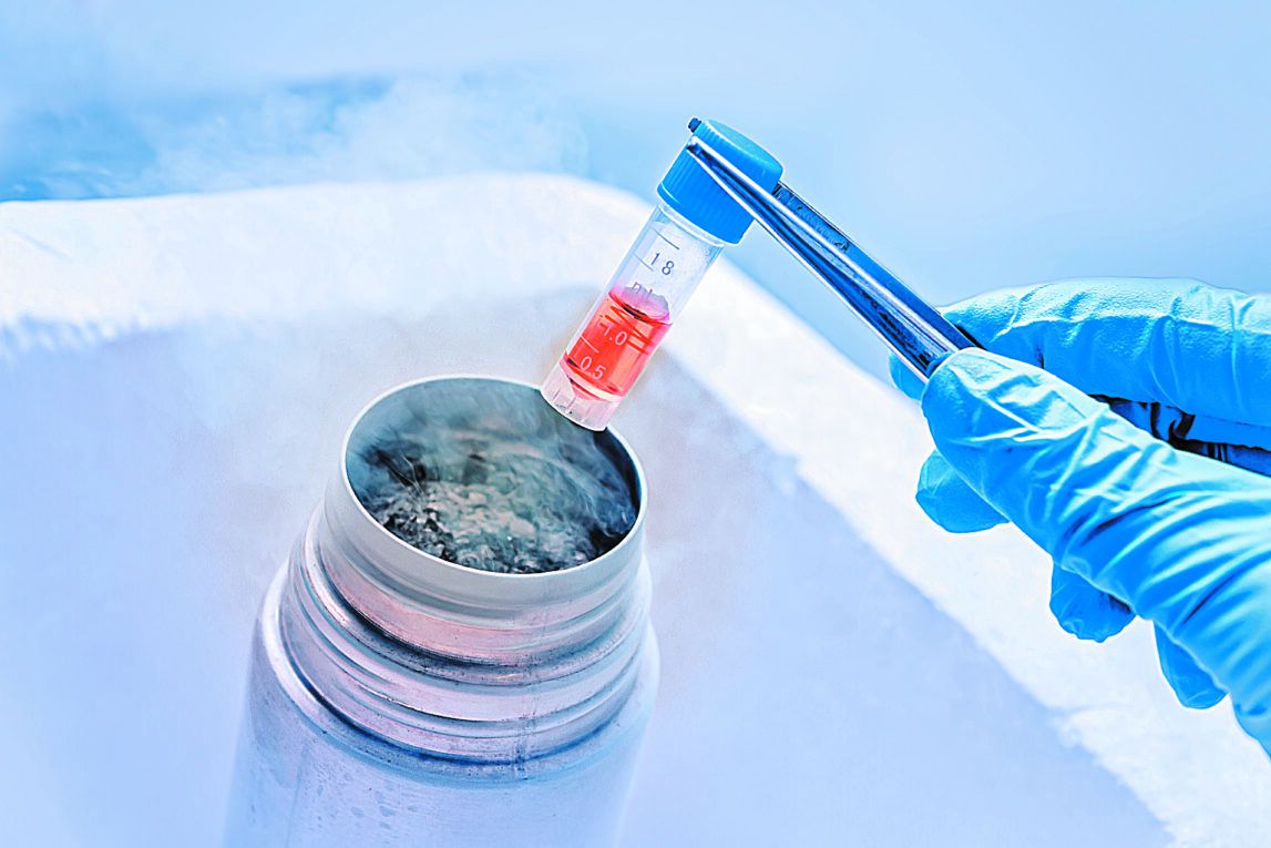 Cell Cryopreservation Market