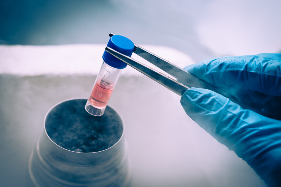 The Global Cell Therapy Market Is Estimated To Propelled By Advancements In Regenerative Medicine