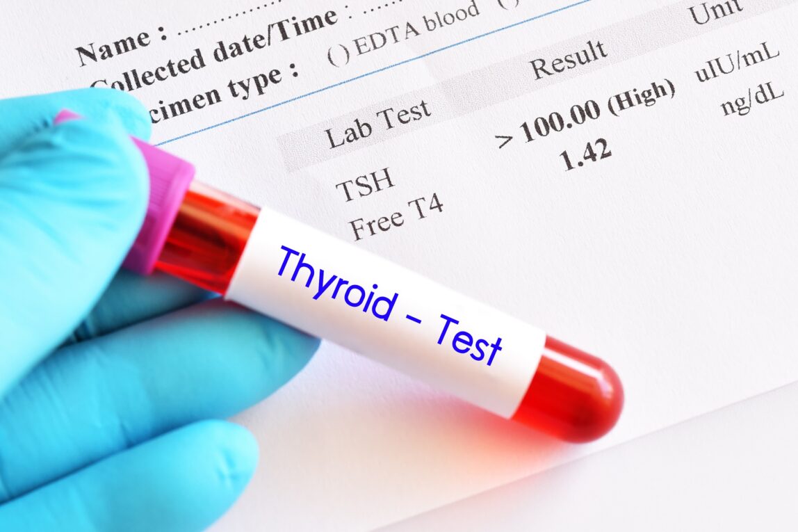 India Thyroid Function Test Market Propelled By Growing Prevalence Of Thyroid Disorders