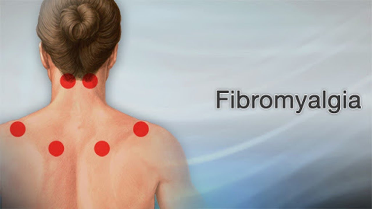 The Global Fibromyalgia Treatment Market is estimated to Driven by increasing research on non-drug therapies