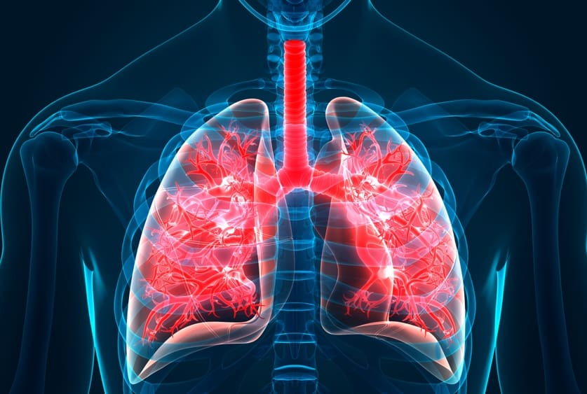 Idiopathic pulmonary fibrosis