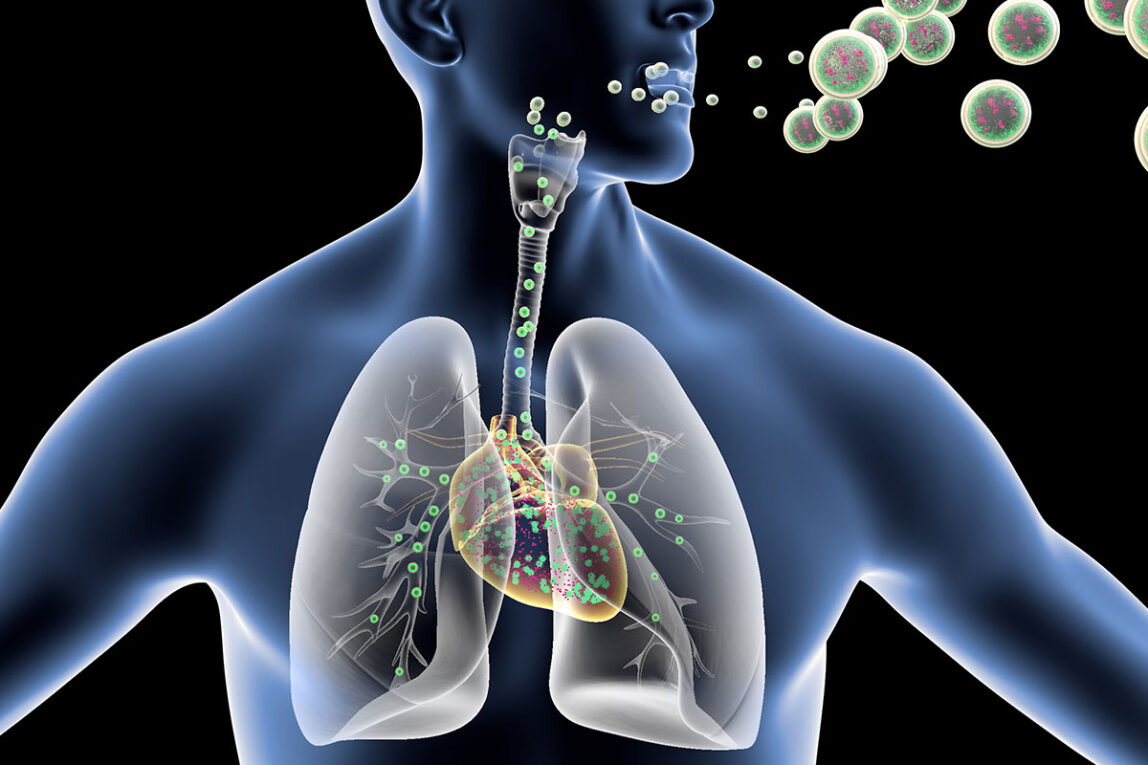 Respiratory Tract Infection Treatment Market is poised for growth by Antibiotic Resistance