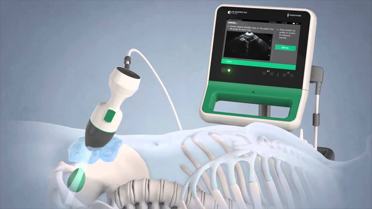 The Power of Precision: How Portable Ultrasound Bladder Scanners Are Transforming Healthcare
