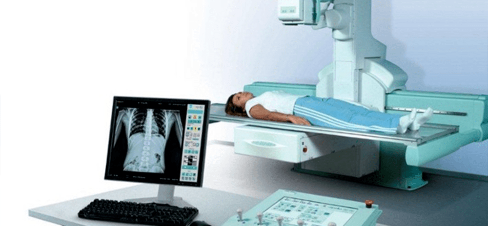 Digital Fluoroscopy Systems: Revolutionizing Medical Imaging