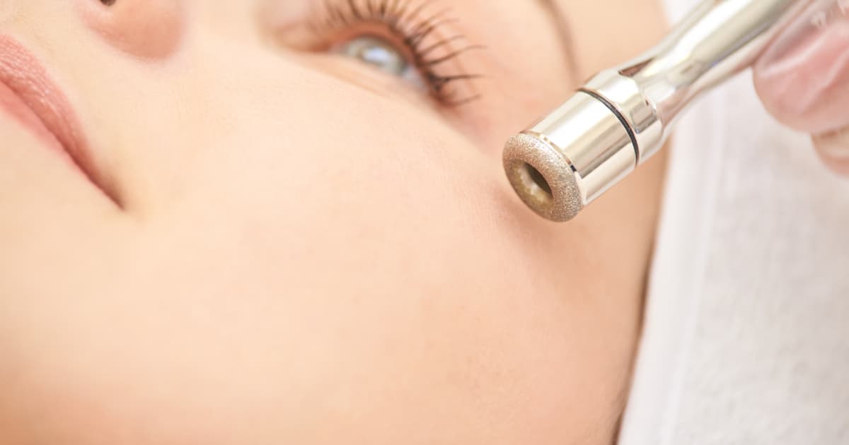 Understanding Microdermabrasion Devices and Their Various Benefits