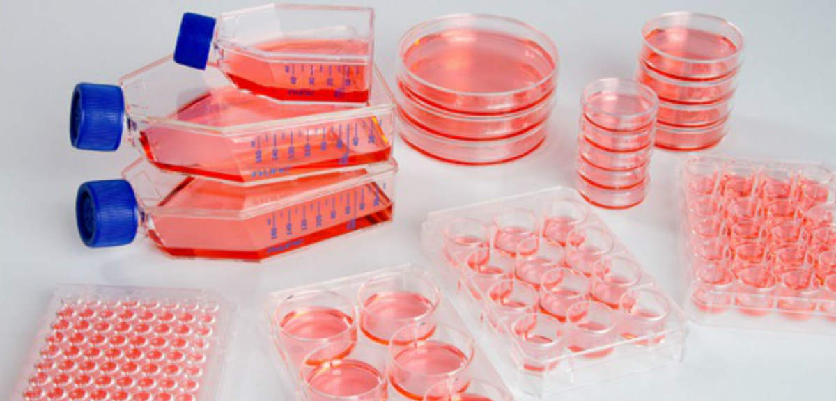 Global Primary Cell Culture Market is Estimated to Witness High Growth Owing to Increasing Demand for Cell-Based Research