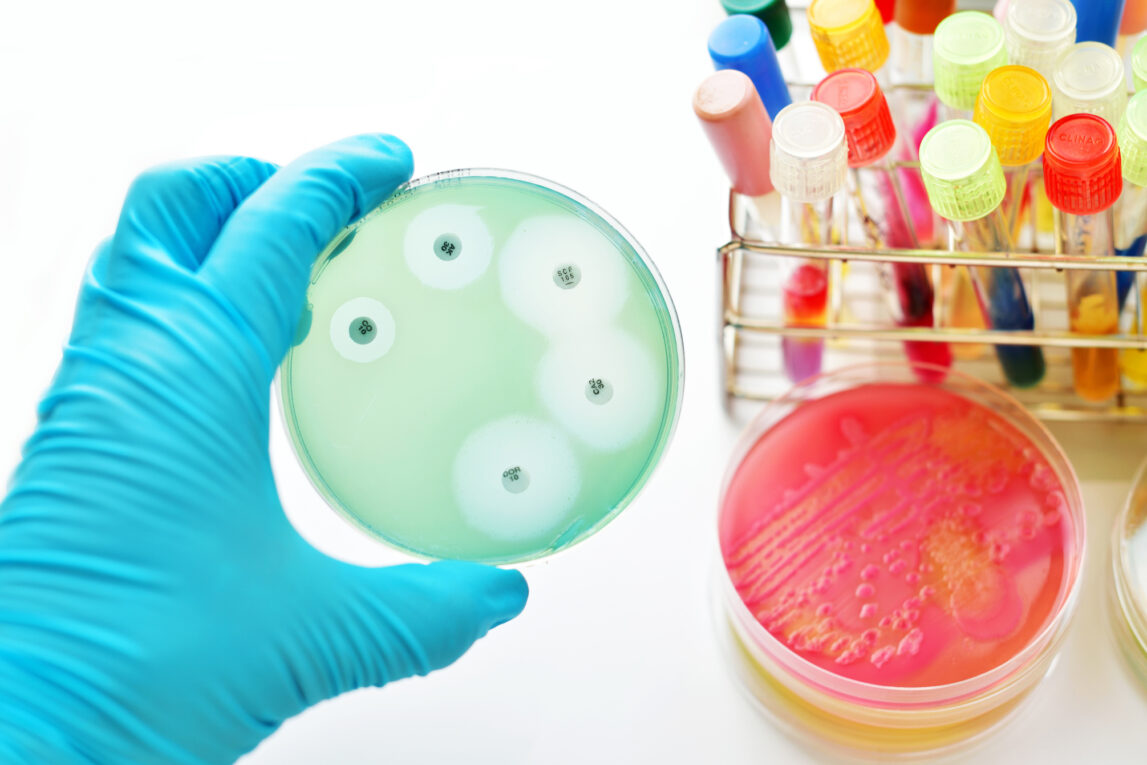 Understanding Antimicrobial Susceptibility Testing: Methods, Interpretation, And Challenges