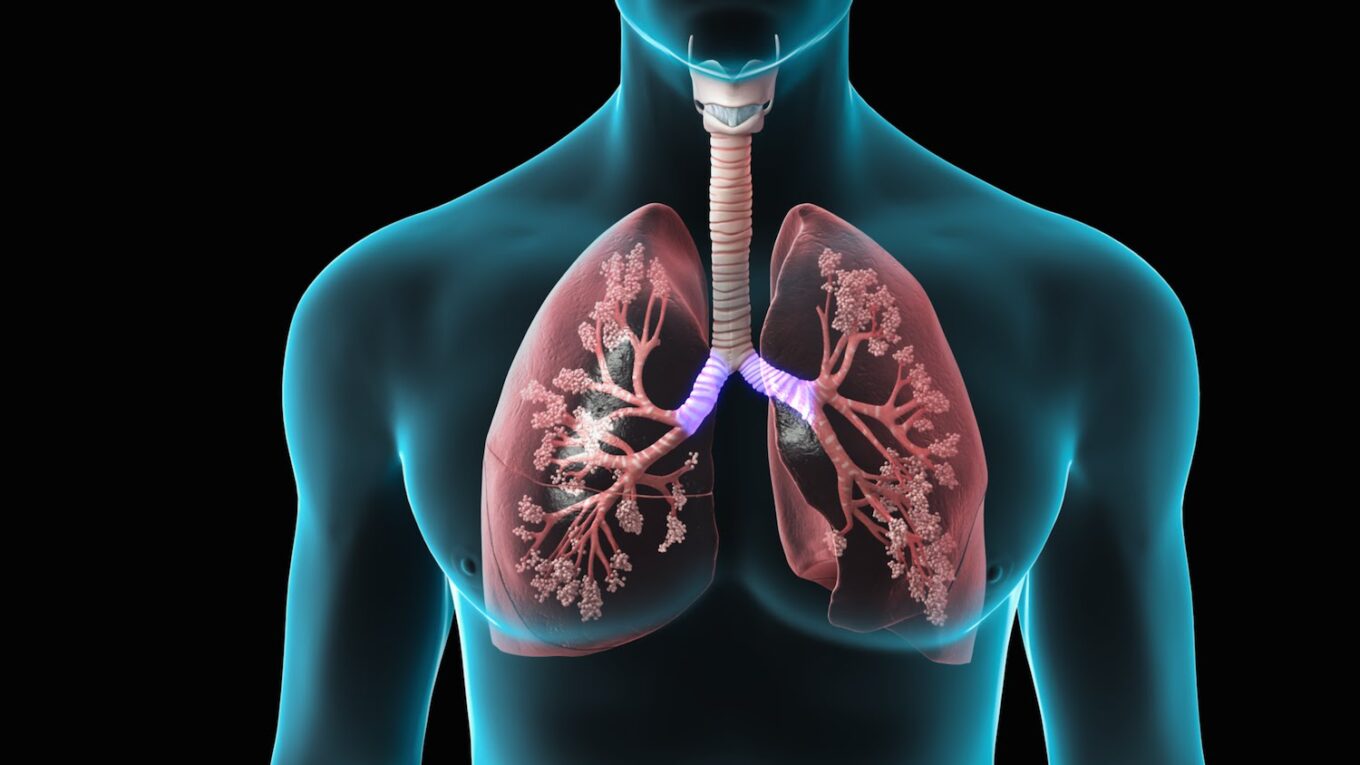 Chronic Obstructive Pulmonary Disease (COPD) Treatment